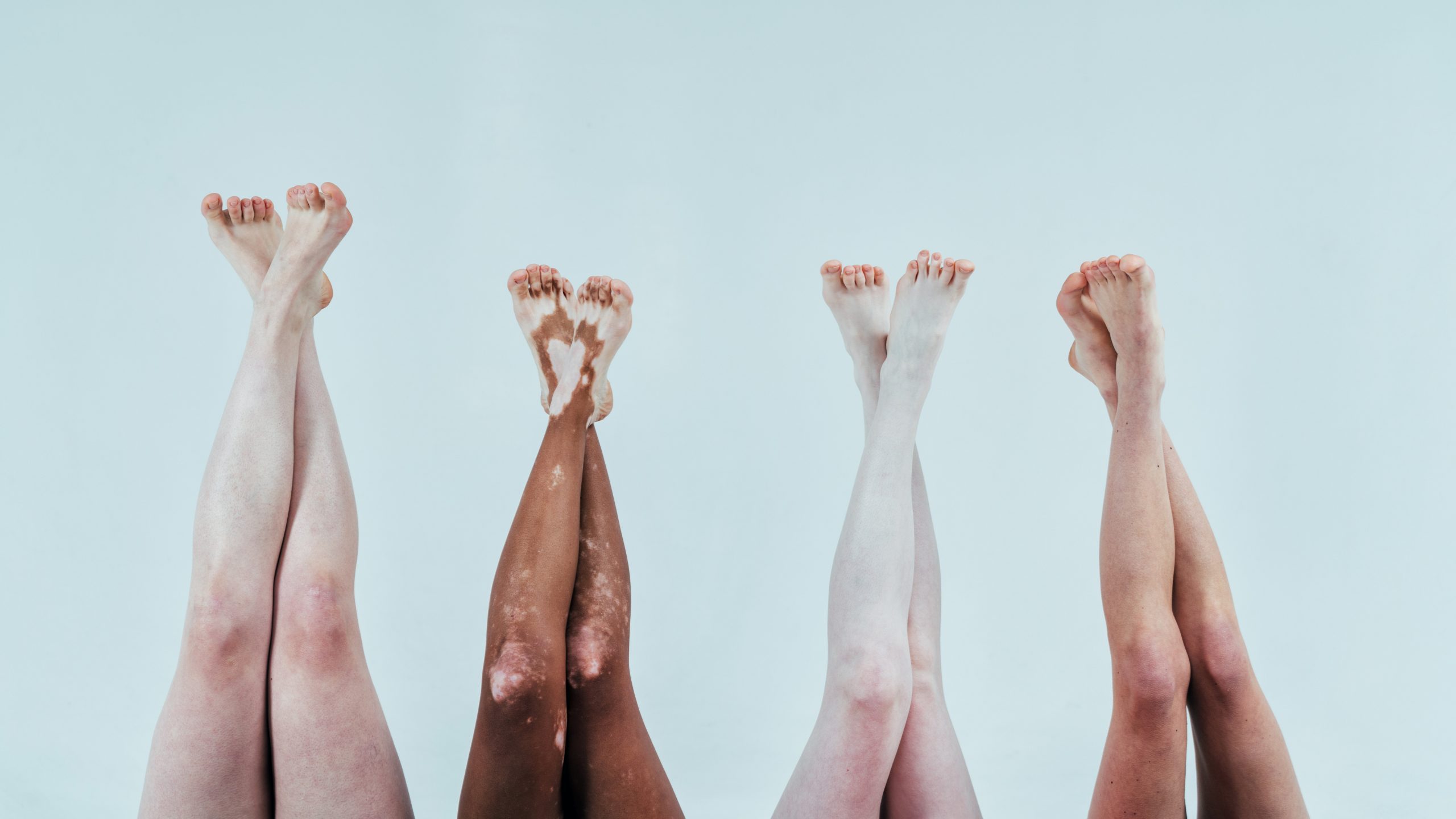 Group of multiethnic women with different kind of skin posing to